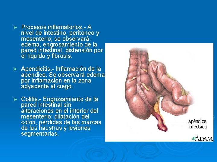 Ø Procesos inflamatorios. - A nivel de intestino, peritoneo y mesenterio; se observará: edema,