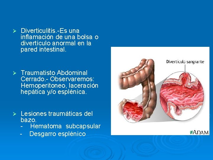 Ø Diverticulitis. -Es una inflamación de una bolsa o divertículo anormal en la pared