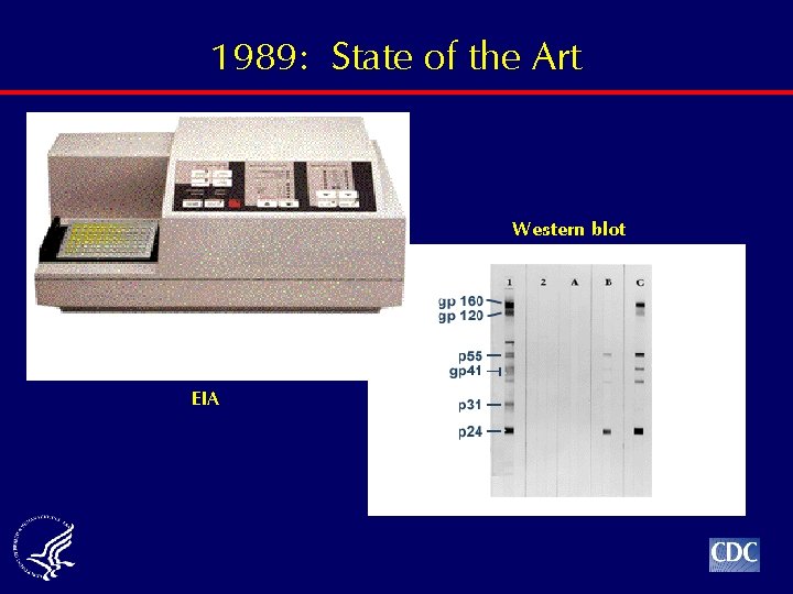 1989: State of the Art Western blot EIA 