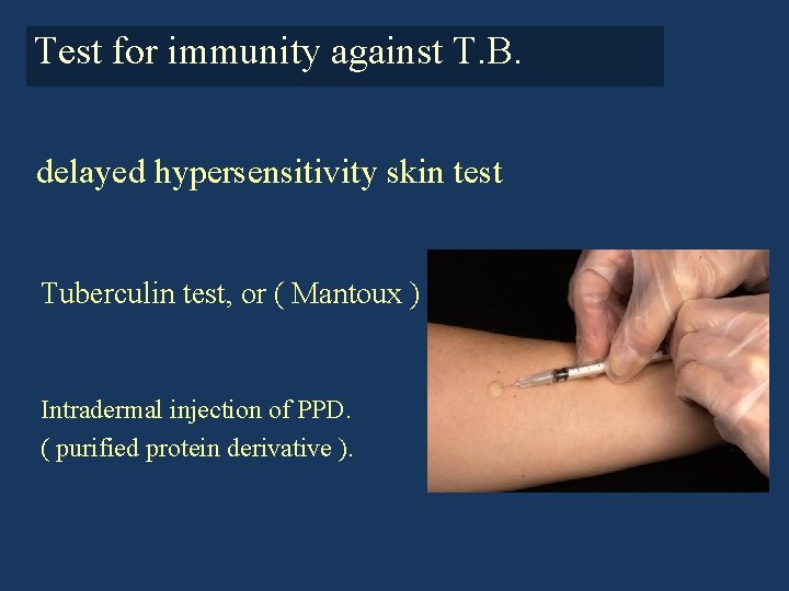 Test for immunity against T. B. delayed hypersensitivity skin test Tuberculin test, or (