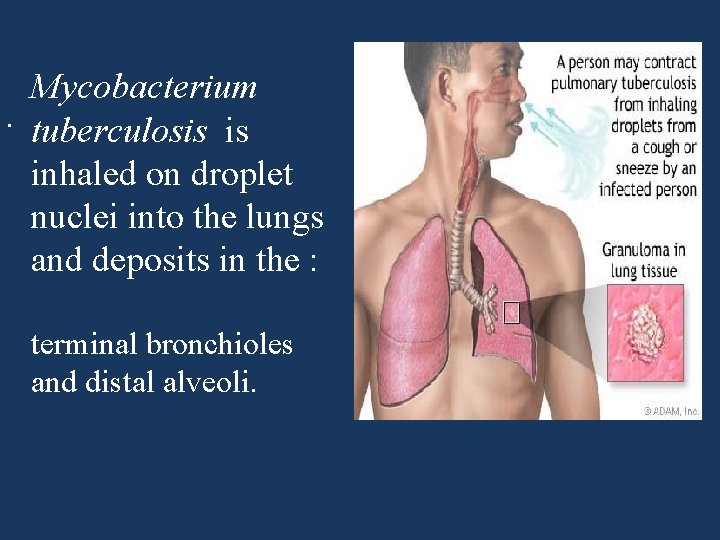 Mycobacterium. tuberculosis is inhaled on droplet nuclei into the lungs and deposits in the