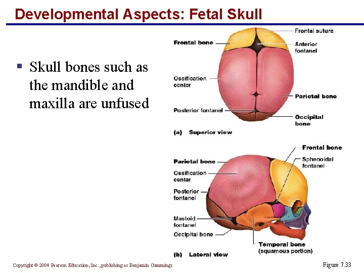 Developmental Aspects: Fetal Skull § Skull bones such as the mandible and maxilla are