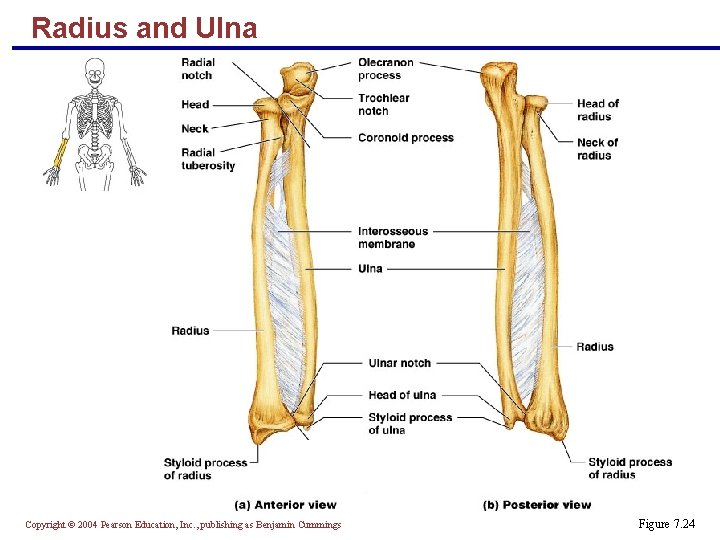 Radius and Ulna Copyright © 2004 Pearson Education, Inc. , publishing as Benjamin Cummings