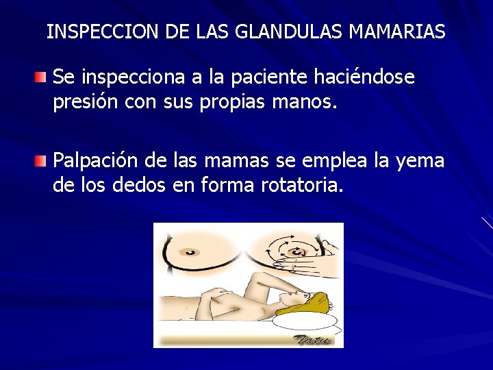 INSPECCION DE LAS GLANDULAS MAMARIAS Se inspecciona a la paciente haciéndose presión con sus
