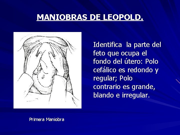 MANIOBRAS DE LEOPOLD. Identifica la parte del feto que ocupa el fondo del útero:
