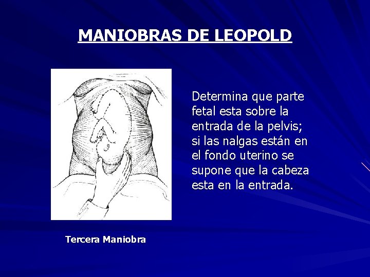 MANIOBRAS DE LEOPOLD Determina que parte fetal esta sobre la entrada de la pelvis;