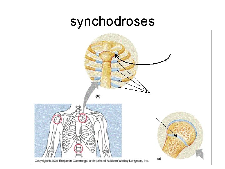 synchodroses 