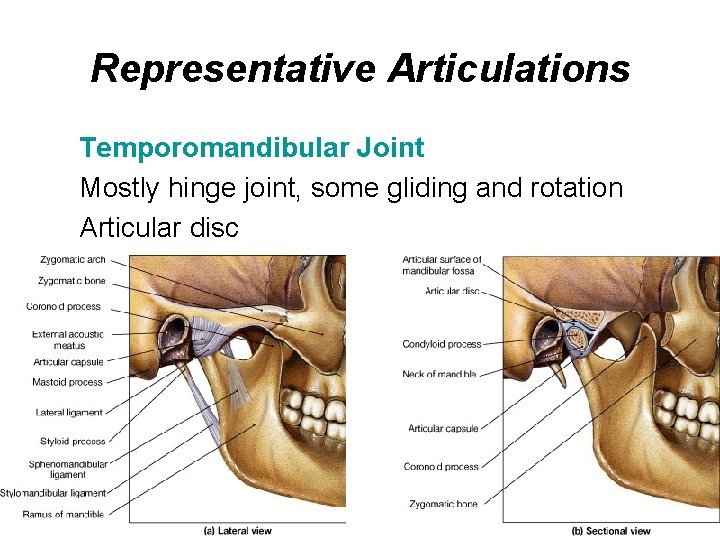 Representative Articulations Temporomandibular Joint Mostly hinge joint, some gliding and rotation Articular disc 