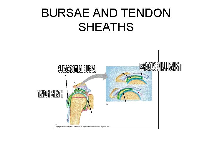 BURSAE AND TENDON SHEATHS 