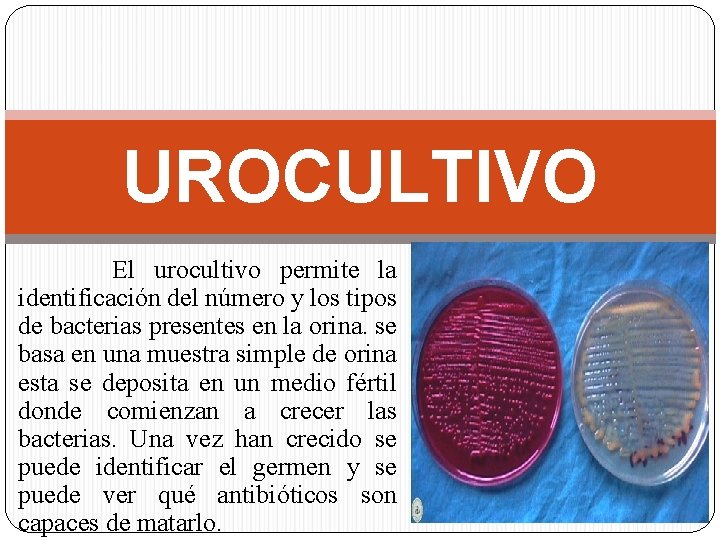 UROCULTIVO El urocultivo permite la identificación del número y los tipos de bacterias presentes