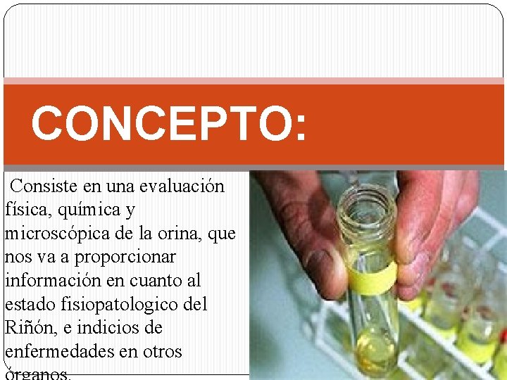 CONCEPTO: Consiste en una evaluación física, química y microscópica de la orina, que nos