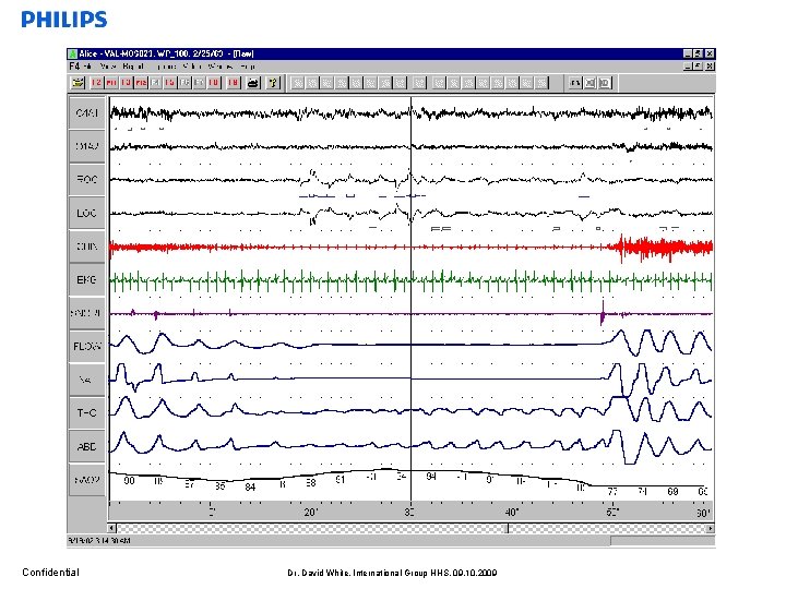 Confidential Dr. David White, International Group HHS, 09. 10. 2009 