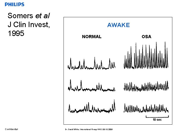 Somers et al J Clin Invest, 1995 AWAKE NORMAL OSA 10 sec Confidential Dr.