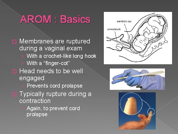 AROM : Basics � Membranes are ruptured during a vaginal exam › With a