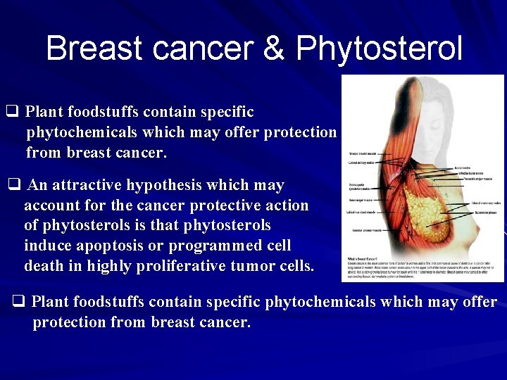 Breast cancer & Phytosterol q Plant foodstuffs contain specific phytochemicals which may offer protection