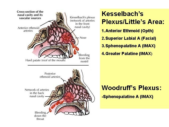 Kesselbach’s Plexus/Little’s Area: 1. Anterior Ethmoid (Opth) 2. Superior Labial A (Facial) 3. Sphenopalatine