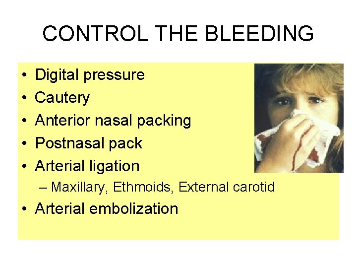 CONTROL THE BLEEDING • • • Digital pressure Cautery Anterior nasal packing Postnasal pack