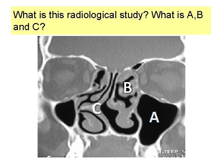 What is this radiological study? What is A, B and C? C B A