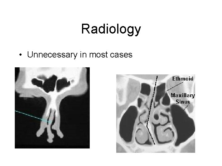 Radiology • Unnecessary in most cases 