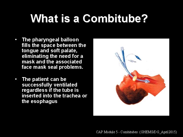 What is a Combitube? • The pharyngeal balloon fills the space between the tongue