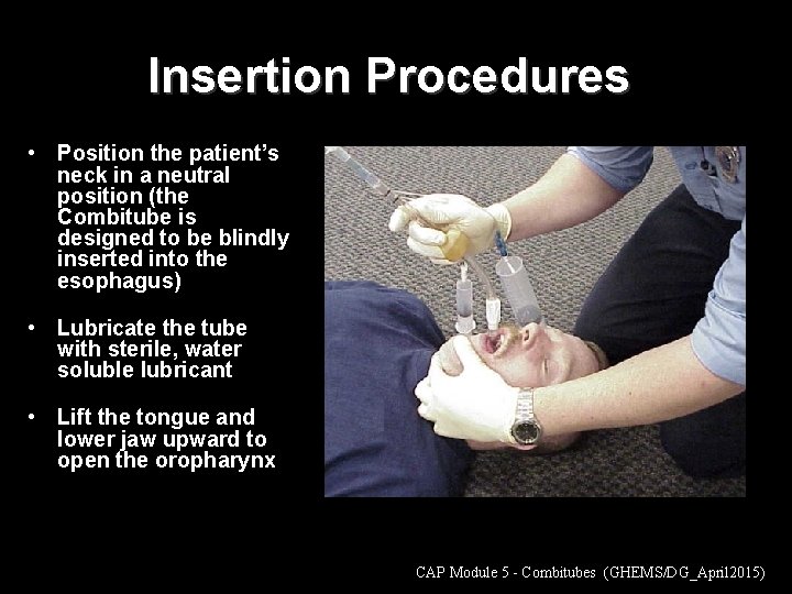 Insertion Procedures • Position the patient’s neck in a neutral position (the Combitube is