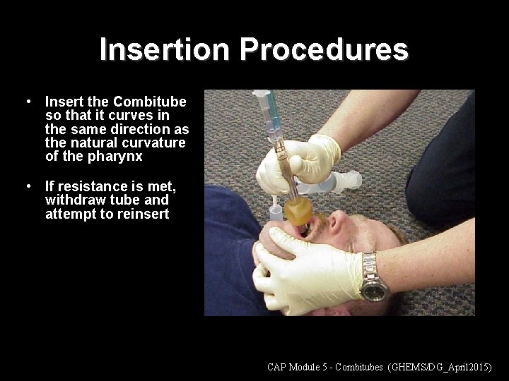 Insertion Procedures • Insert the Combitube so that it curves in the same direction