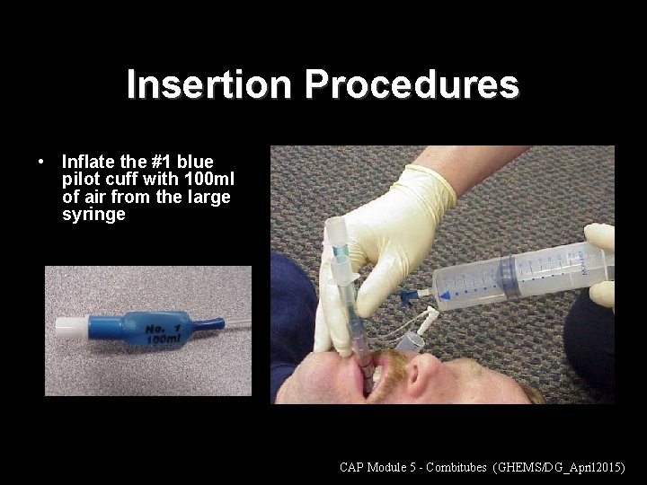 Insertion Procedures • Inflate the #1 blue pilot cuff with 100 ml of air