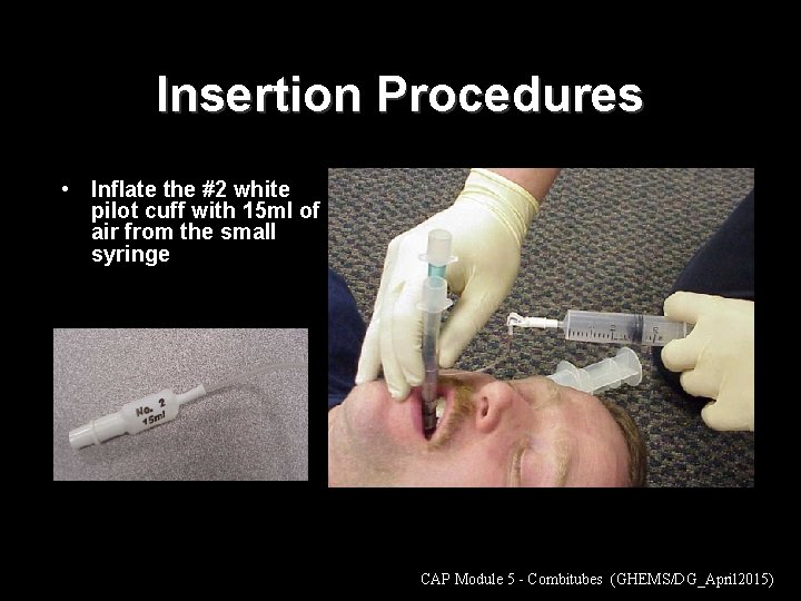 Insertion Procedures • Inflate the #2 white pilot cuff with 15 ml of air