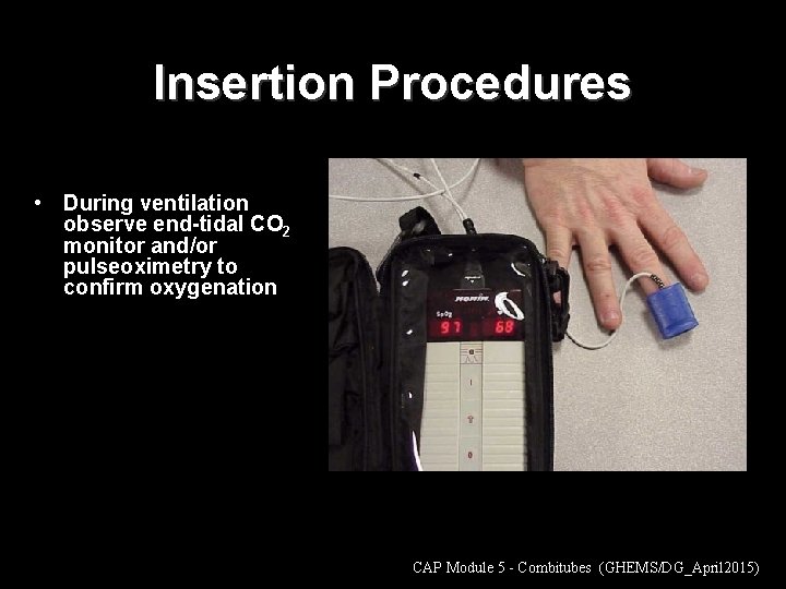 Insertion Procedures • During ventilation observe end-tidal CO 2 monitor and/or pulseoximetry to confirm