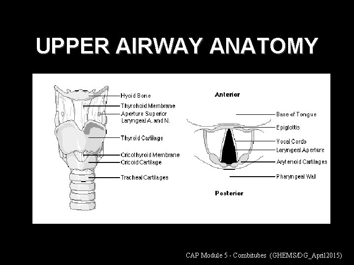 UPPER AIRWAY ANATOMY CAP Module 5 - Combitubes (GHEMS/DG_April 2015) 