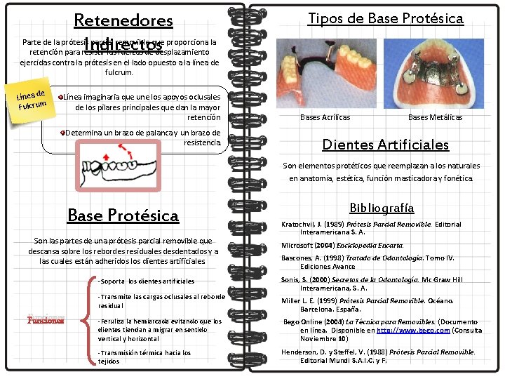 Retenedores Parte de la prótesis parcial removible que proporciona la Indirectos retención para resistir