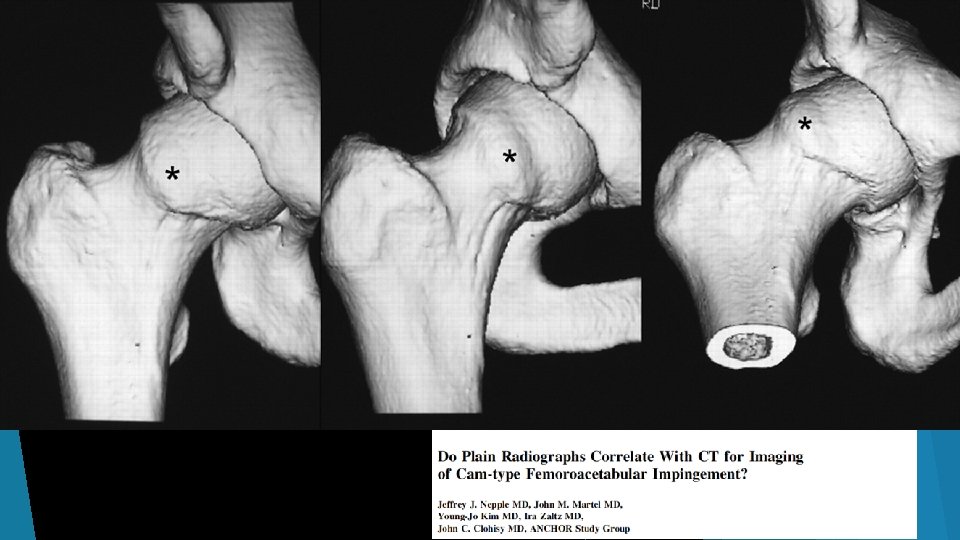Standard Views I recommend AP and Frog Leg views 