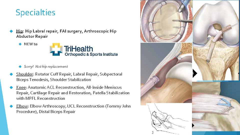 Specialties Hip: Hip Labral repair, FAI surgery, Arthroscopic Hip Abductor Repair NEW to Sorry!
