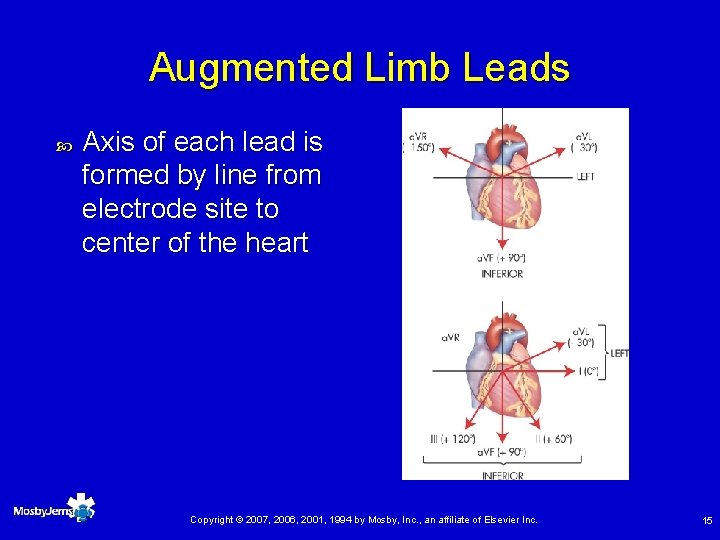 Augmented Limb Leads Axis of each lead is formed by line from electrode site