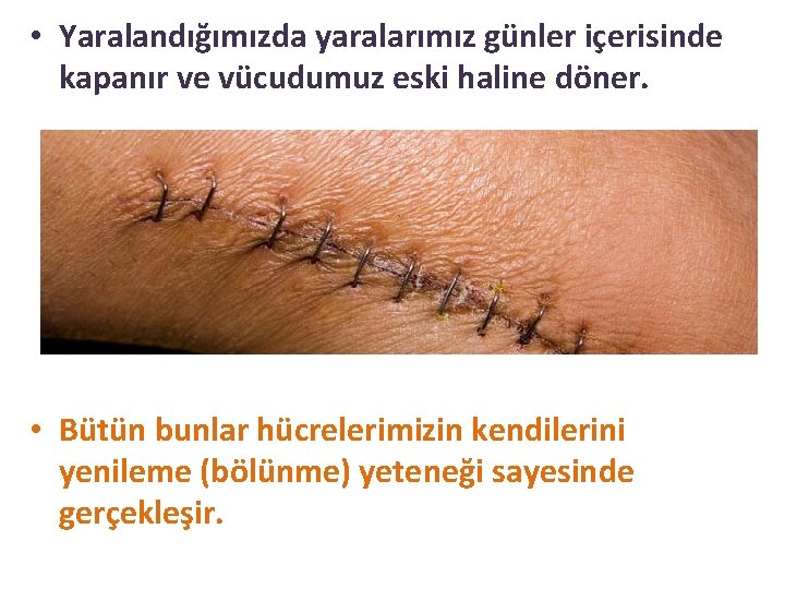  • Yaralandığımızda yaralarımız günler içerisinde kapanır ve vücudumuz eski haline döner. • Bütün