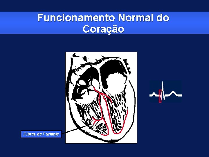 Funcionamento Normal do Coração Fibras de Purkinje 