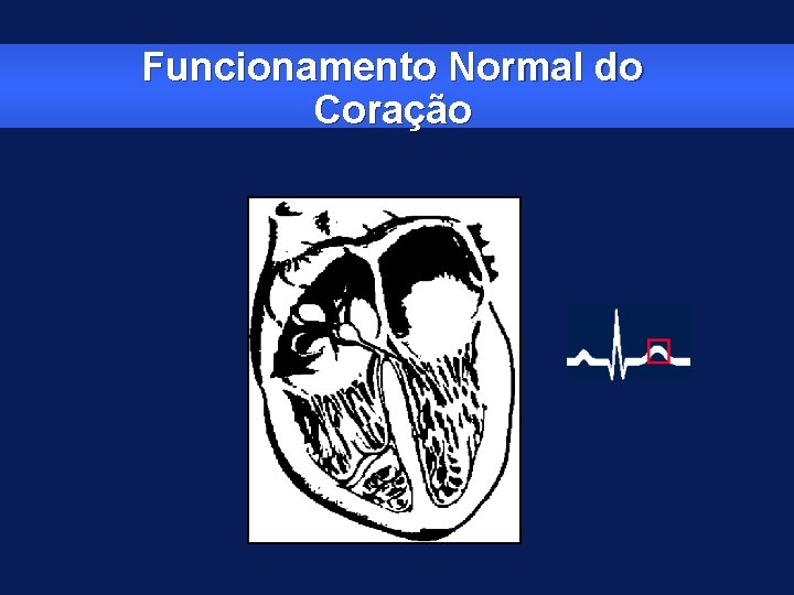 Funcionamento Normal do Coração 