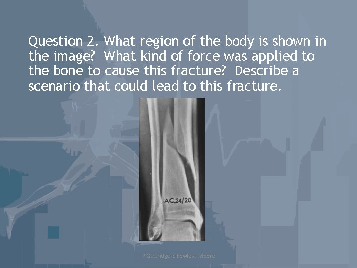 Question 2. What region of the body is shown in the image? What kind
