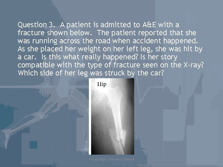 Question 3. A patient is admitted to A&E with a fracture shown below. The