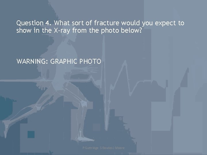 Question 4. What sort of fracture would you expect to show in the X-ray