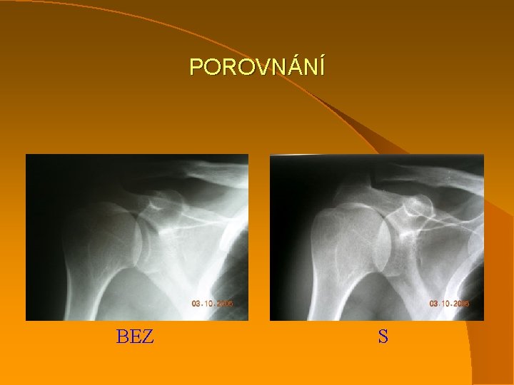 POROVNÁNÍ BEZ S 