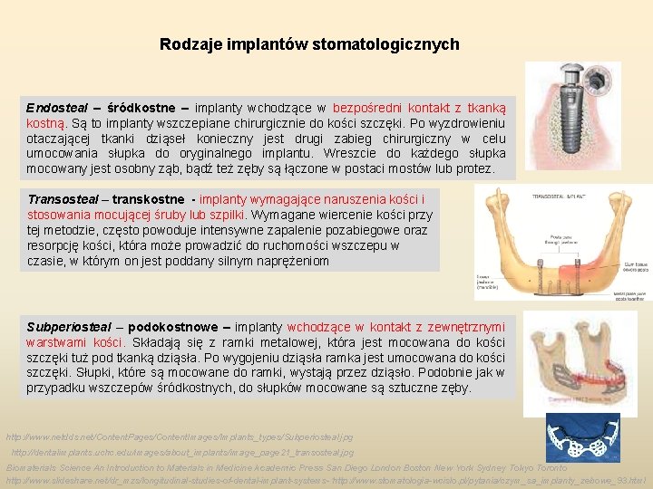 Rodzaje implantów stomatologicznych Endosteal – śródkostne – implanty wchodzące w bezpośredni kontakt z tkanką