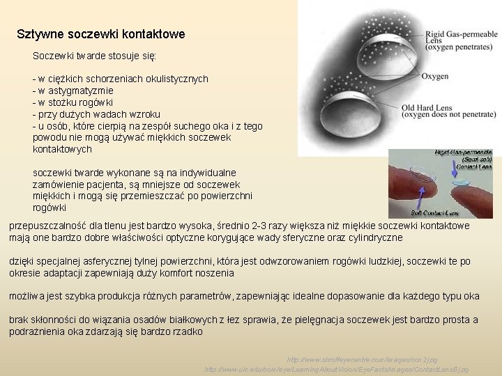 Sztywne soczewki kontaktowe Soczewki twarde stosuje się: - w ciężkich schorzeniach okulistycznych - w