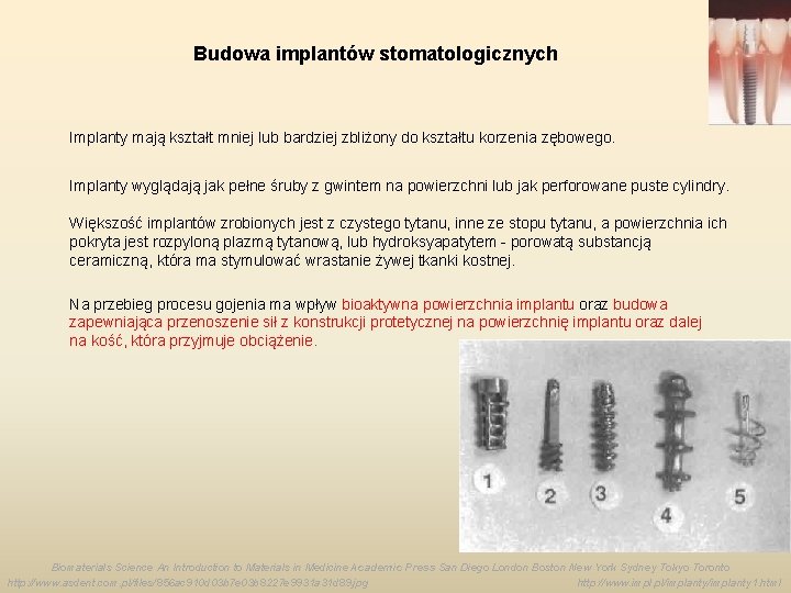 Budowa implantów stomatologicznych Implanty mają kształt mniej lub bardziej zbliżony do kształtu korzenia zębowego.