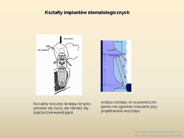 Kształty implantów stomatologicznych Na każdy wszczep działają nie tylko pionowe siły żucia, ale również