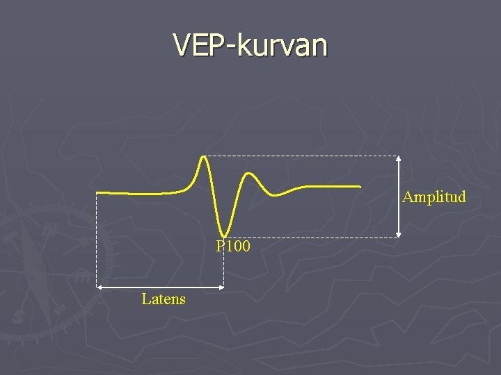 VEP-kurvan Amplitud P 100 Latens 