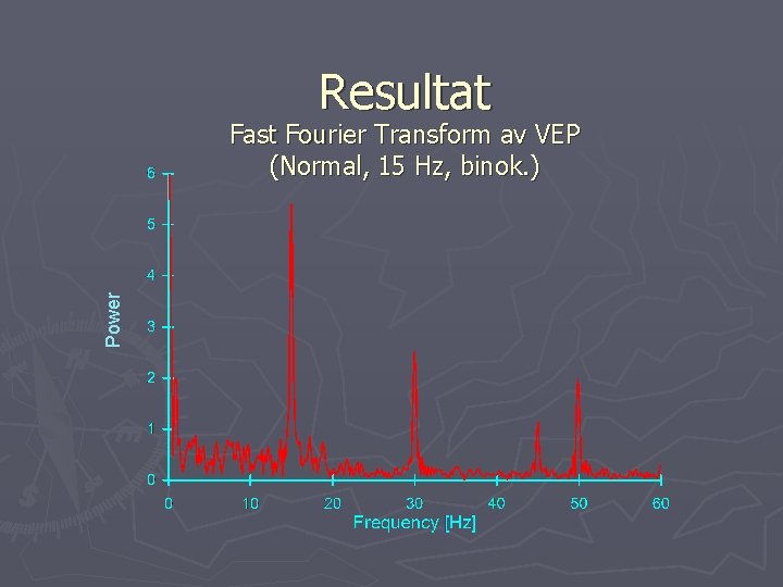 Resultat Power Fast Fourier Transform av VEP (Normal, 15 Hz, binok. ) 