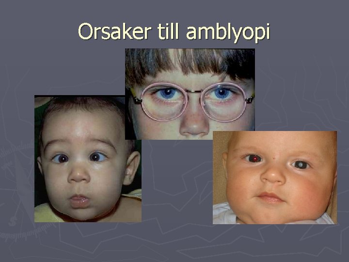 Orsaker till amblyopi 