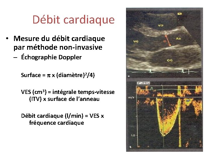 Débit cardiaque • Mesure du débit cardiaque par méthode non-invasive – Échographie Doppler Surface