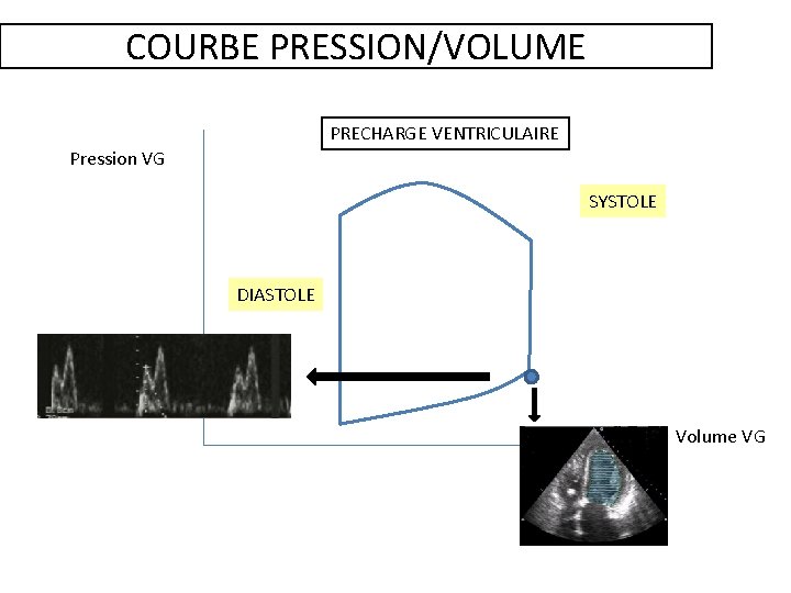 COURBE PRESSION/VOLUME PRECHARGE VENTRICULAIRE Pression VG SYSTOLE DIASTOLE Volume VG 